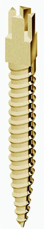 Screwpost Titan L1 15pcs