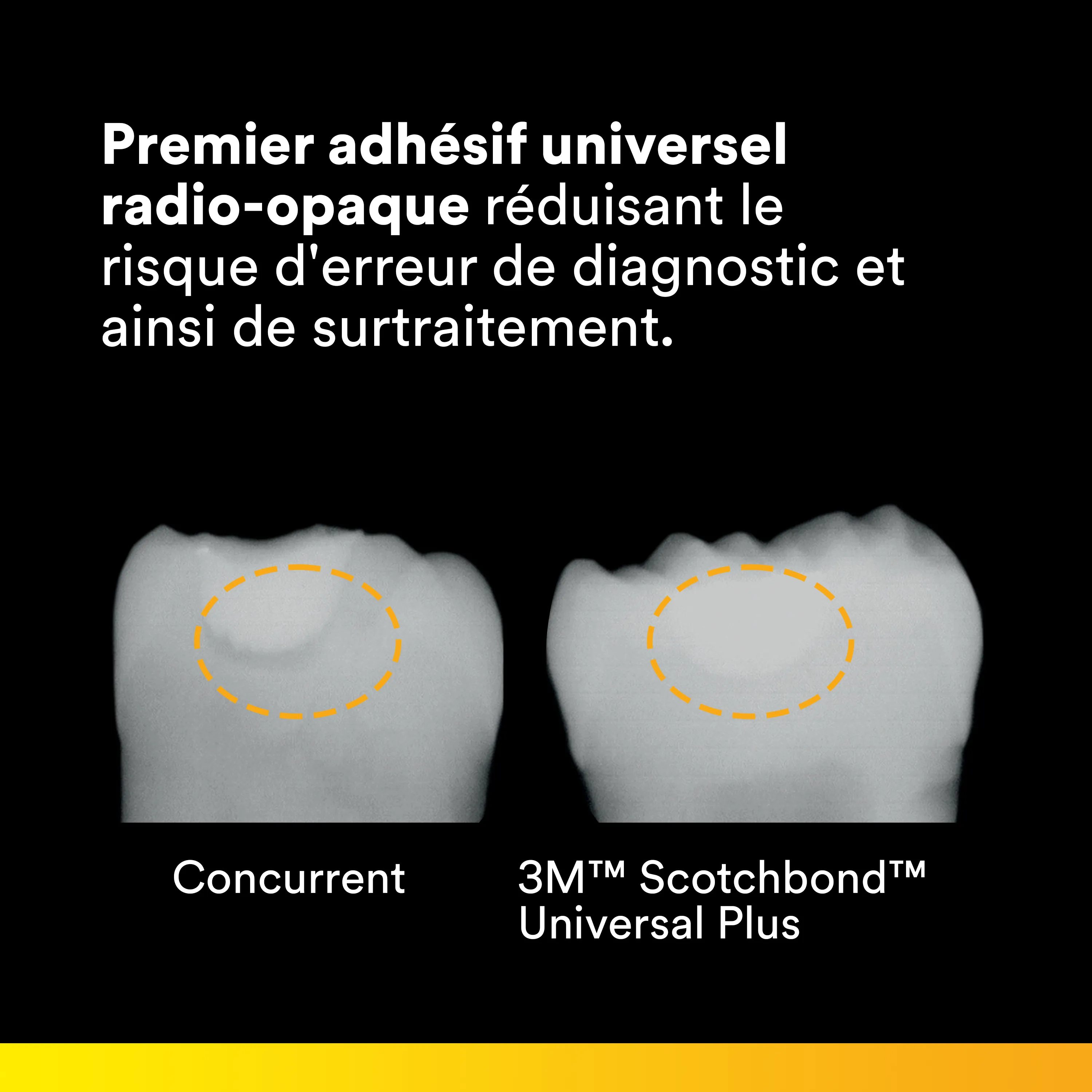 3M™ Scotchbond™ Universal Plus Adhésif, boîte d'introduction avec 50 L-Pop