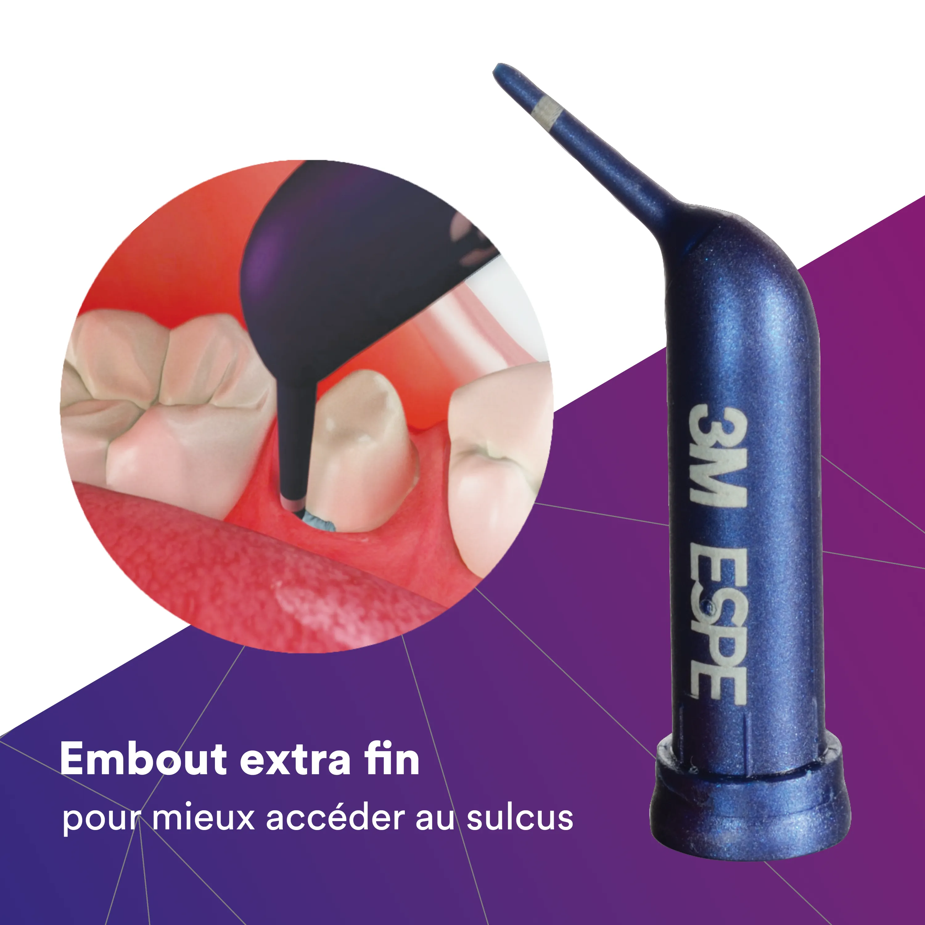 3M™ ARP Cap Pâte de rétraction gingivale, boîte géante 100 capsules